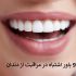 9 اشتباه رایج در مراقبت از دندان که از آن بی اطلاع هستید!