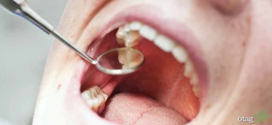 9 روش برای درمان دندان درد در شب