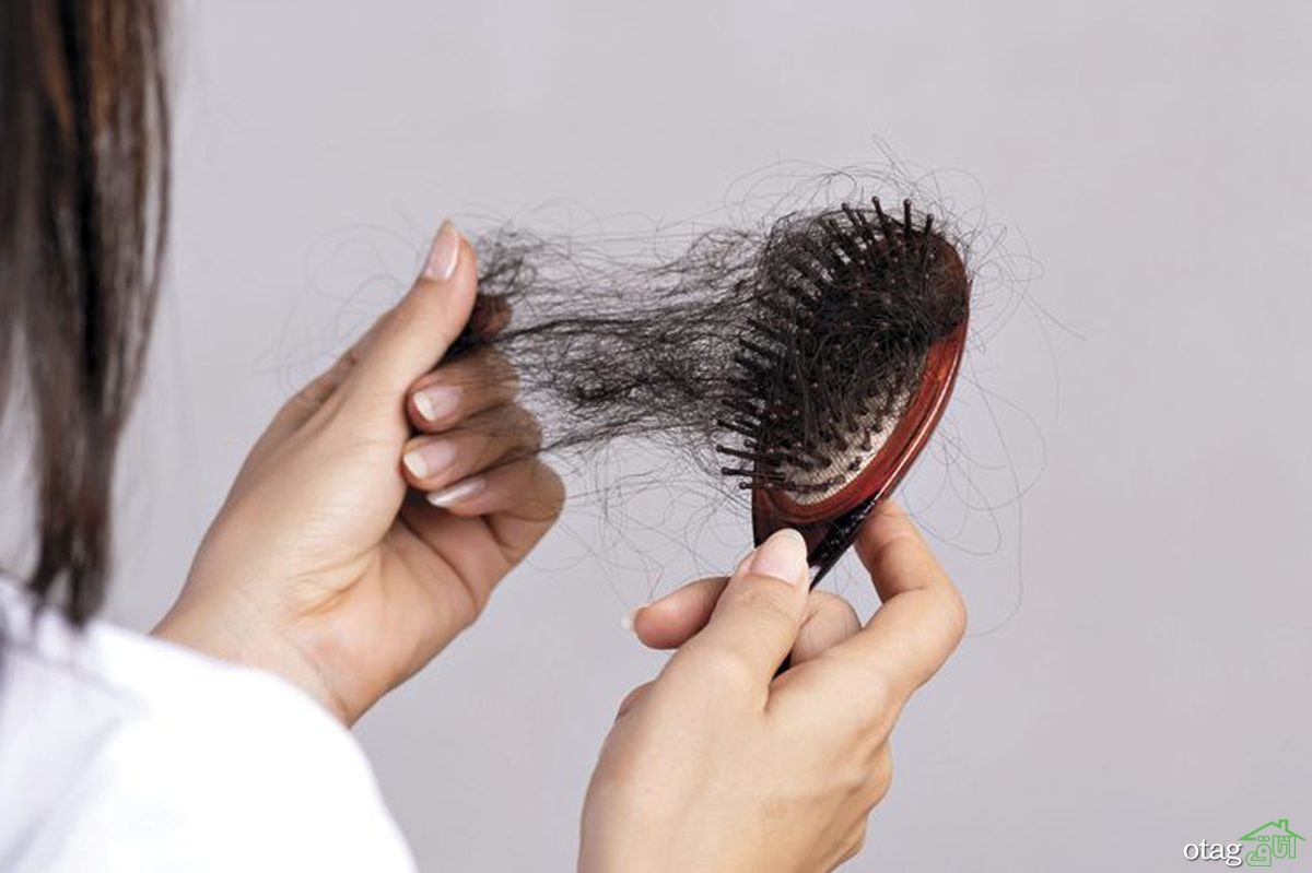 مهم‌ترین راه‌های جلوگیری از ریزش مو
