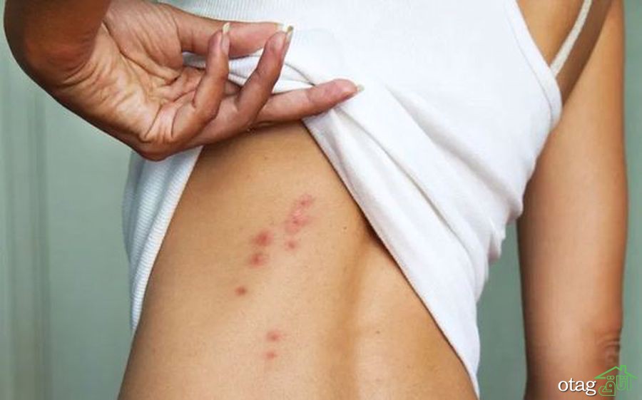 چگونه ساس را در خانه از بین ببریم؟