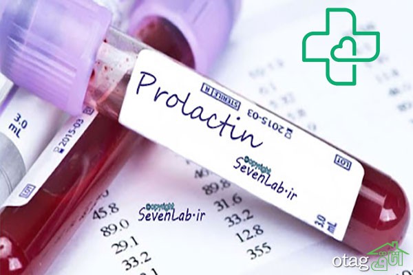 آزمایش پرولاکتین Prolactin چیست و چه کاربردی دارد؟ آزمایش پرولاکتین Prolactin چیست و چه کاربردی دارد؟