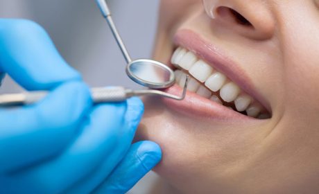 چرا تعرفه دندانپزشکی متغیر است؟ بررسی عوامل تأثیرگذار بر قیمت‌ها